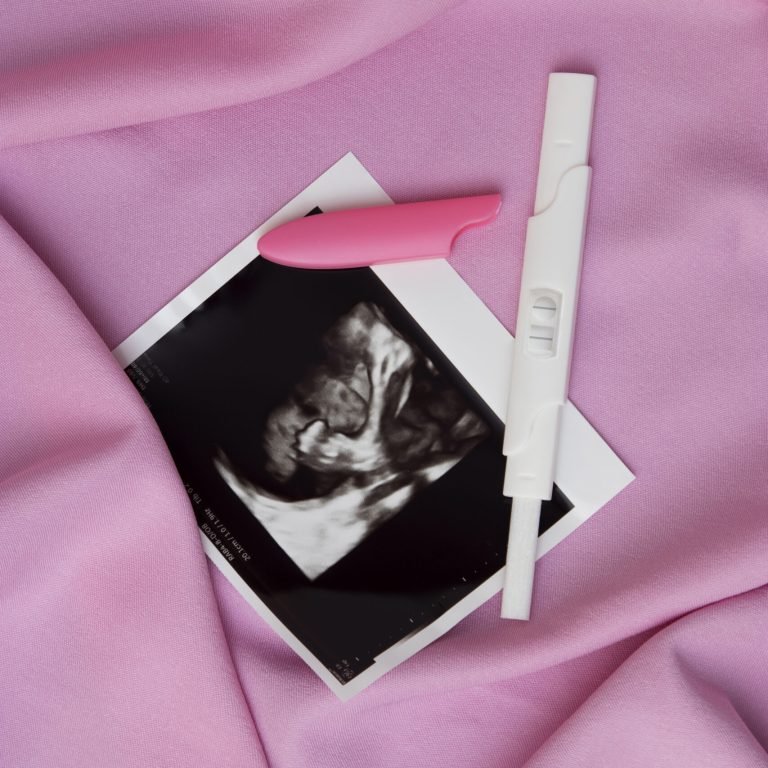 top-view-positive-pregnancy-test-ultrasound